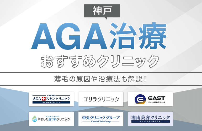 神戸でAGA治療におすすめのクリニック10選【2024】薄毛の原因や治療法も解説！| ボイスノートマガジン