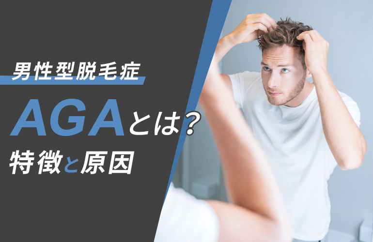 AGA（男性型脱毛症）とは？特徴と原因