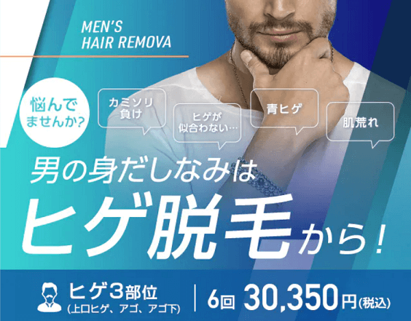 354人が選ぶ 名古屋のメンズ脱毛ランキング 22 ヒゲ脱毛やvioでおすすめの人気サロンやクリニックはここ ボイスノートマガジン